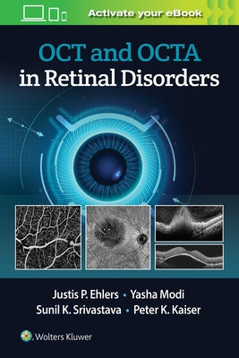 Oct and Octa in Retinal Disorders by Ehlers, Justis P.