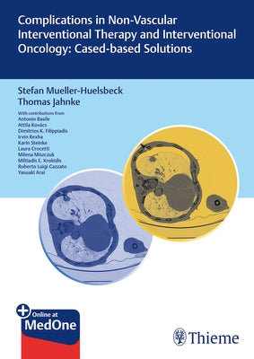 Complications in Non-Vascular Interventional Therapy and Interventional Oncology: Case-Based Solutions by Müller-Hülsbeck, Stefan