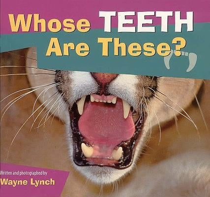 Whose Teeth Are These? by Lynch, Wayne