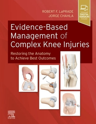 Evidence-Based Management of Complex Knee Injuries: Restoring the Anatomy to Achieve Best Outcomes by Laprade, Robert F.