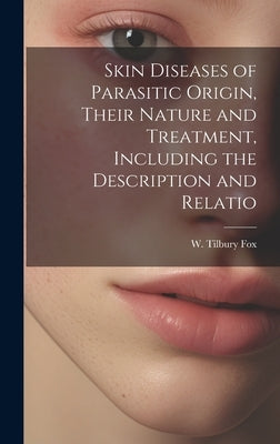Skin Diseases of Parasitic Origin, Their Nature and Treatment, Including the Description and Relatio by Fox, W. Tilbury