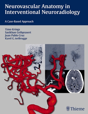 Neurovascular Anatomy in Interventional Neuroradiology: A Case-Based Approach by Krings, Timo