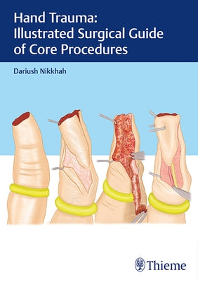 Hand Trauma: Illustrated Surgical Guide of Core Procedures by Nikkhah, Dariush