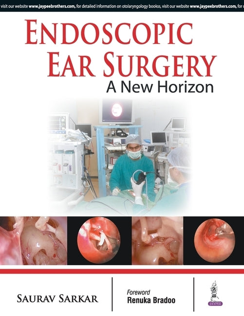 Endoscopic Ear Surgery: A New Horizon by Sarkar, Saurav