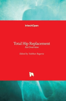 Total Hip Replacement: An Overview by Bagaria, Vaibhav