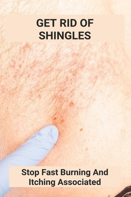 Get Rid Of Shingles: Stop Fast Burning And Itching Associated: Shingles On Face Treatment by Voetmann, Mana