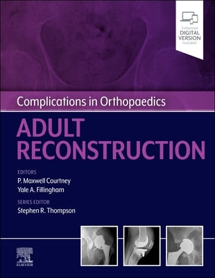 Complications in Orthopaedics: Adult Reconstruction by Courtney, Paul Maxwell