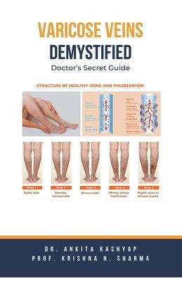 Varicose Veins Demystified: Doctor's Secret Guide by Kashyap, Ankita