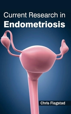 Current Research in Endometriosis by Flagstad, Chris