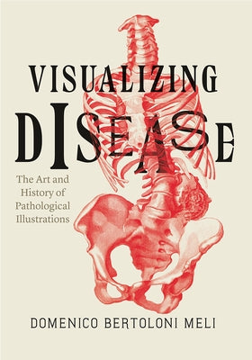 Visualizing Disease: The Art and History of Pathological Illustrations by Bertoloni Meli, Domenico