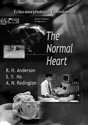 Echo-Morphologic Correlates: The Normal Heart (with Video) [With *] by Anderson, Robert Henry