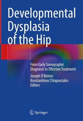 Developmental Dysplasia of the Hip: From Early Sonographic Diagnosis to Effective Treatment by O'Beirne, Joseph
