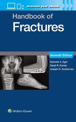 Handbook of Fractures: Print + eBook with Multimedia by Egol, Kenneth A.