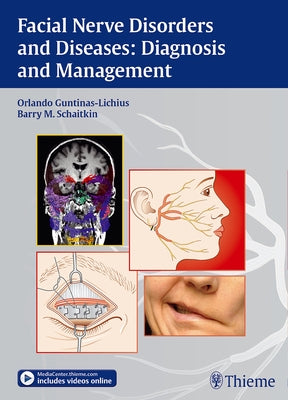Facial Nerve Disorders and Diseases: Diagnosis and Management by Guntinas-Lichius, Orlando