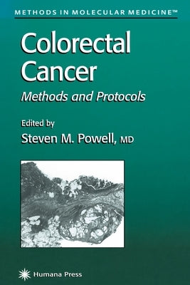 Colorectal Cancer: Methods and Protocols by Powell, Steven M.