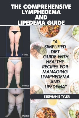 The Comprehensive Lymphedema and Lipedema Guide: The Comprehensive Lymphedema and Lipedema Guide by Tyler, Stephanie