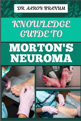 Knowledge Guide to Morton's Neuroma: Essential Manual To Symptoms, Diagnosis, Treatment, And Pain Relief For Foot Health And Nerve Pain Management by Branum, Aaron