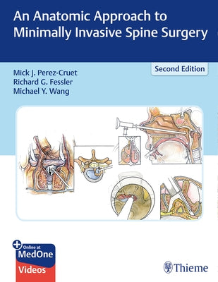 An Anatomic Approach to Minimally Invasive Spine Surgery by Perez-Cruet, Miguelangelo