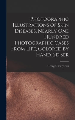 Photographic Illustrations of Skin Diseases, Nearly One Hundred Photographic Cases From Life, Colored by Hand. 2d Ser by Fox, George Henry 1846-1937