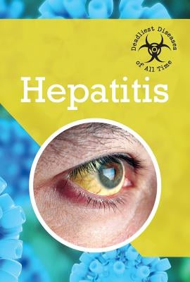 Hepatitis by Miller, Petra