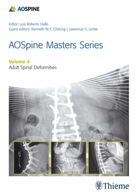 Aospine Master Series, Vol. 4: Adult Spinal Deformities by Lenke, Lawrence G.