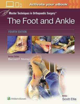 Master Techniques in Orthopaedic Surgery: The Foot and Ankle: Print + eBook with Multimedia by Ellis, Scott