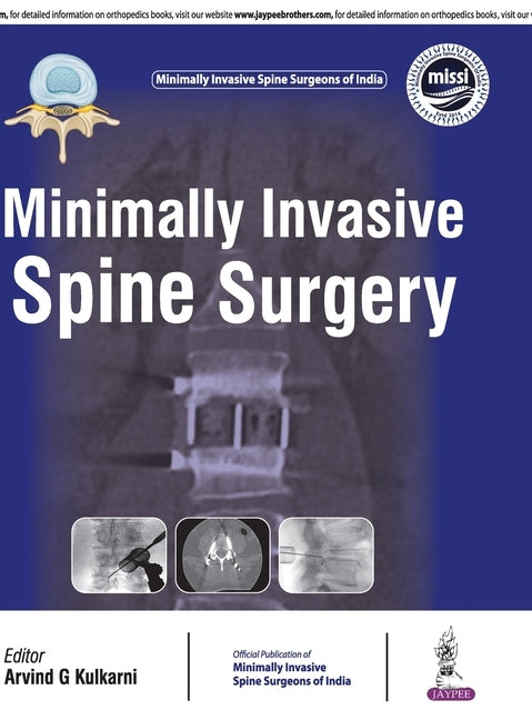 Minimally Invasive Spine Surgery by Kulkarni, Arvind G.