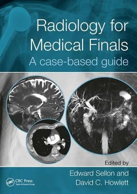 Radiology for Medical Finals: A Case-Based Guide by Sellon, Edward