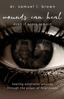 Wounds Can Heal, Even If Scars Remain by Brown, Samuel