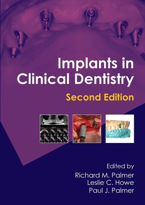 Implants in Clinical Dentistry by Palmer, Richard M.
