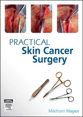 Practical Skin Cancer Surgery by Hayes, Mileham