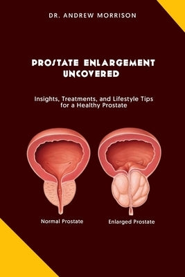 Prostrate Enlargement Uncovered: Insights, Treatments, and Lifestyle Tips for a Healthy Prostate by Morrison, Andrew