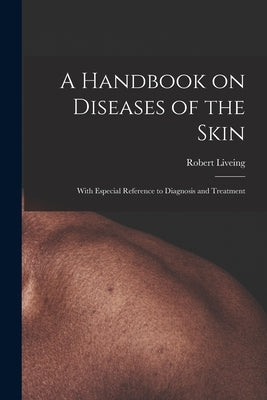 A Handbook on Diseases of the Skin [electronic Resource]: With Especial Reference to Diagnosis and Treatment by Liveing, Robert 1834-1919