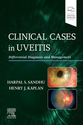 Clinical Cases in Uveitis: Differential Diagnosis and Management by Sandhu, Harpal