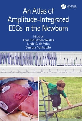 An Atlas of Amplitude-Integrated Eegs in the Newborn by Hellström-Westas, Lena
