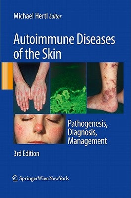 Autoimmune Diseases of the Skin: Pathogenesis, Diagnosis, Management by Hertl, Michael