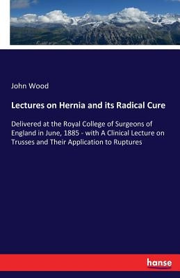 Lectures on Hernia and its Radical Cure: Delivered at the Royal College of Surgeons of England in June, 1885 - with A Clinical Lecture on Trusses and by Wood, John