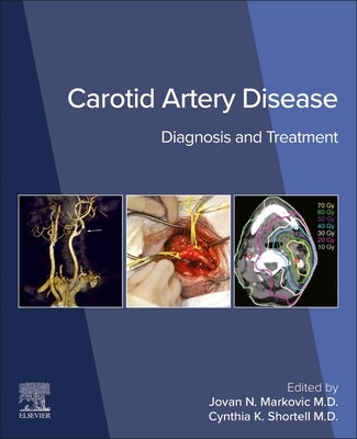 Carotid Artery Disease by Shortell, Cynthia K.