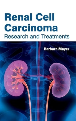 Renal Cell Carcinoma: Research and Treatments by Mayer, Barbara