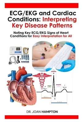 ECG/EKG and Cardiac Conditions: Interpreting Key Disease Patterns: Noting Key ECG/EKG Signs of Heart Conditions for Easy Interpretation for All by Hampton, Joan