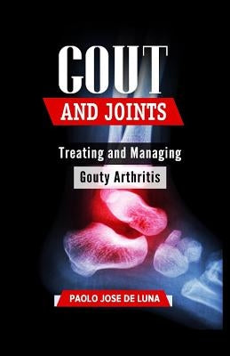 Gout and Joints: Treating and Managing Gouty Arthritis by Jose De Luna, Paolo