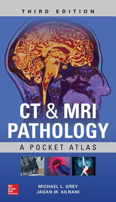 CT & MRI Pathology: A Pocket Atlas, Third Edition by Grey, Michael