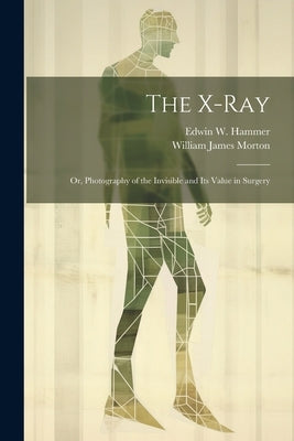 The X-Ray; Or, Photography of the Invisible and Its Value in Surgery by Morton, William James