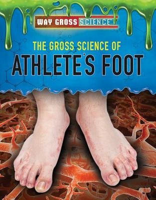 The Gross Science of Athlete's Foot by Kamberg, Mary-Lane