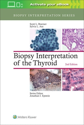 Biopsy Interpretation of the Thyroid by Boerner, Scott L.