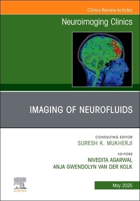 Imaging of Neurofluids, an Issue of Neuroimaging Clinics of North America: Volume 35-2 by Agarwal, Nivedita