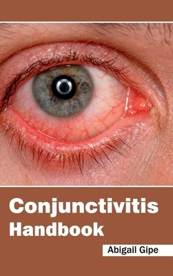Conjunctivitis Handbook by Gipe, Abigail