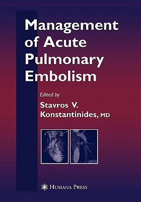 Management of Acute Pulmonary Embolism by Konstantinides, Stavros V.