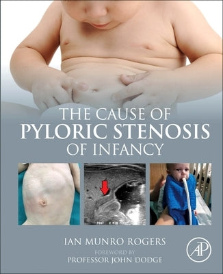 The Cause of Pyloric Stenosis of Infancy by Rogers, Ian Munro