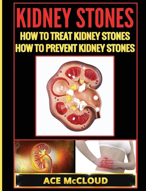 Kidney Stones: How To Treat Kidney Stones: How To Prevent Kidney Stones by McCloud, Ace